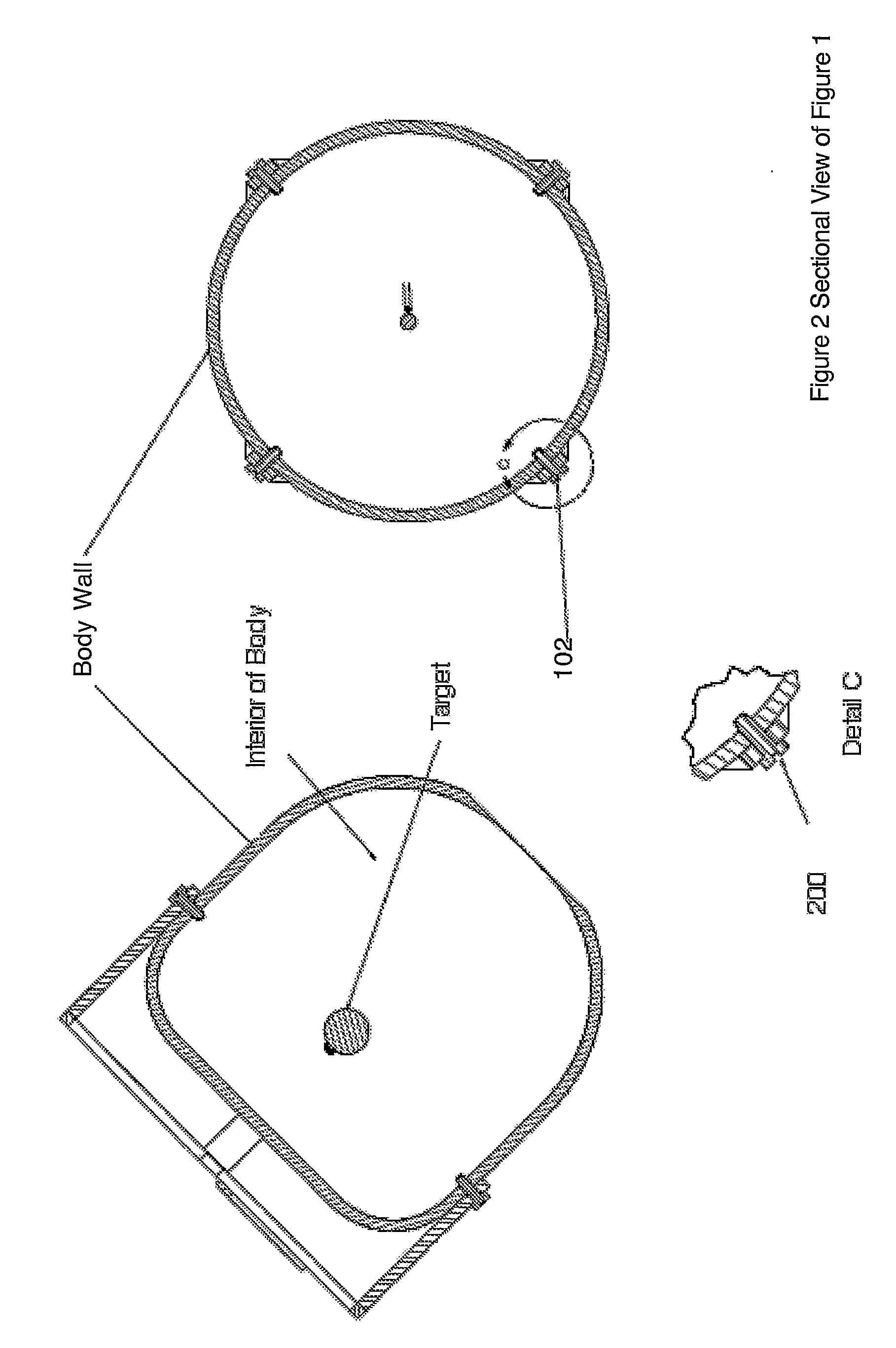 Percutaneous medical devices and methods