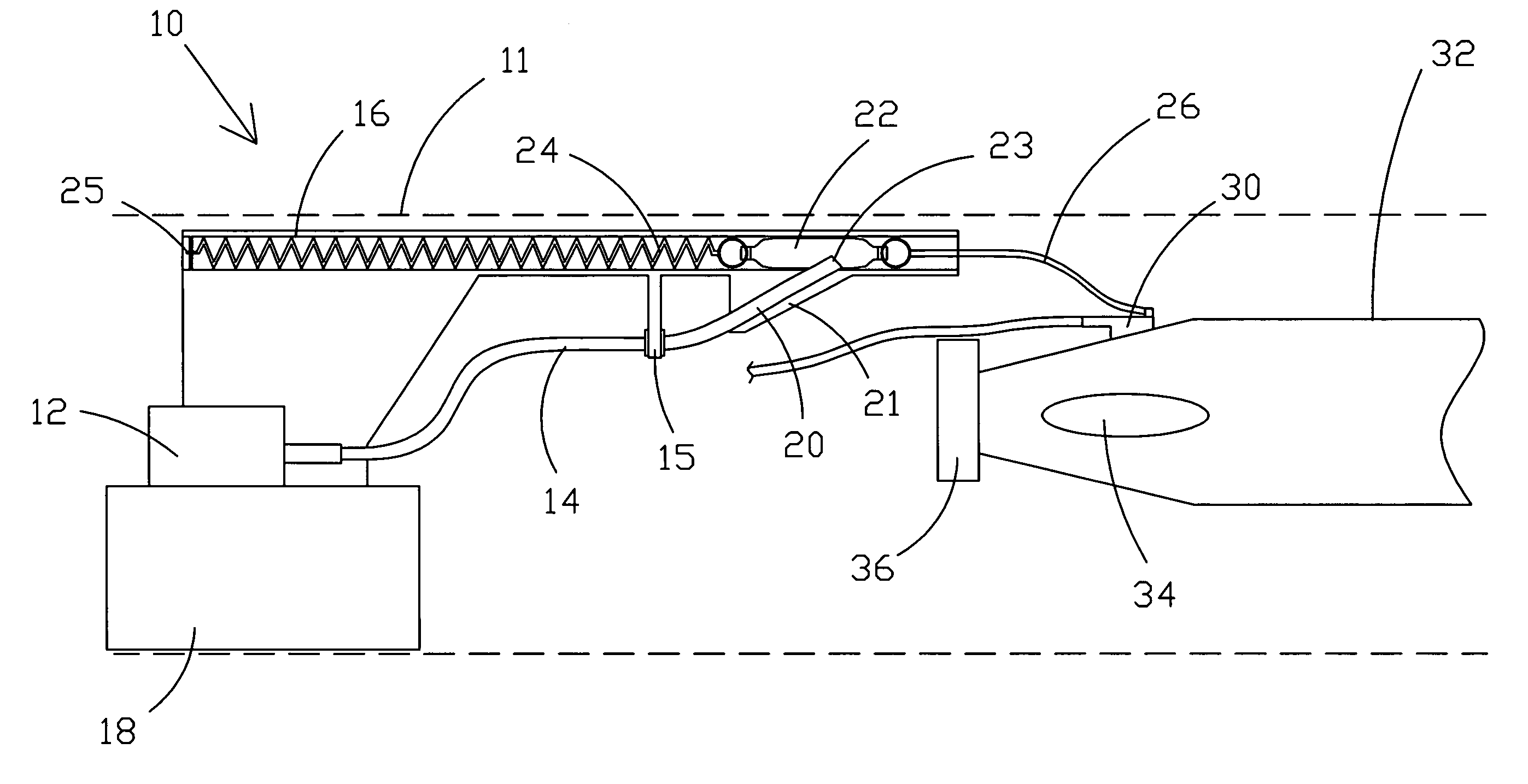 Umbilical retraction assembly and method