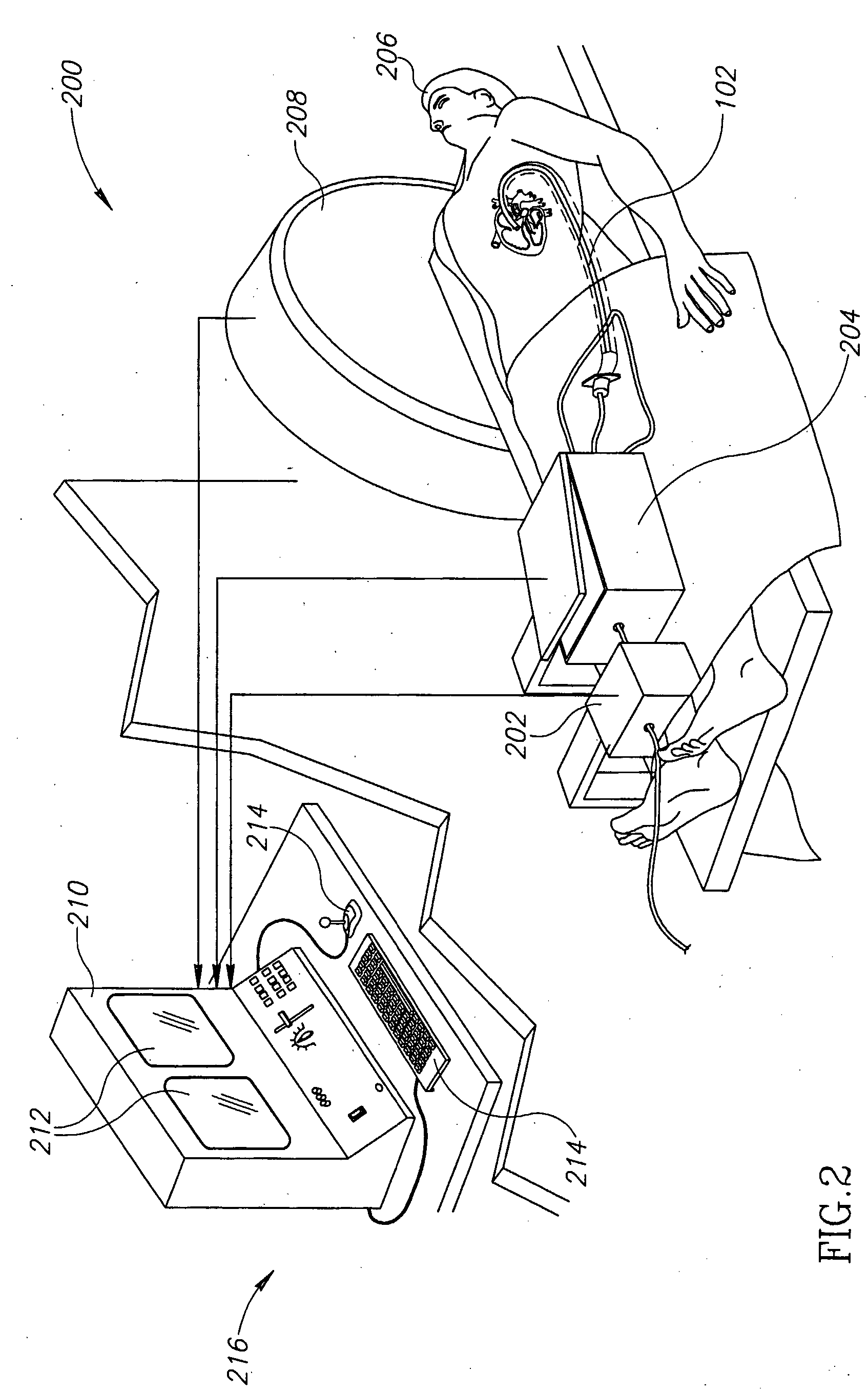 Methods and apparatuses for treatment of hollow organs