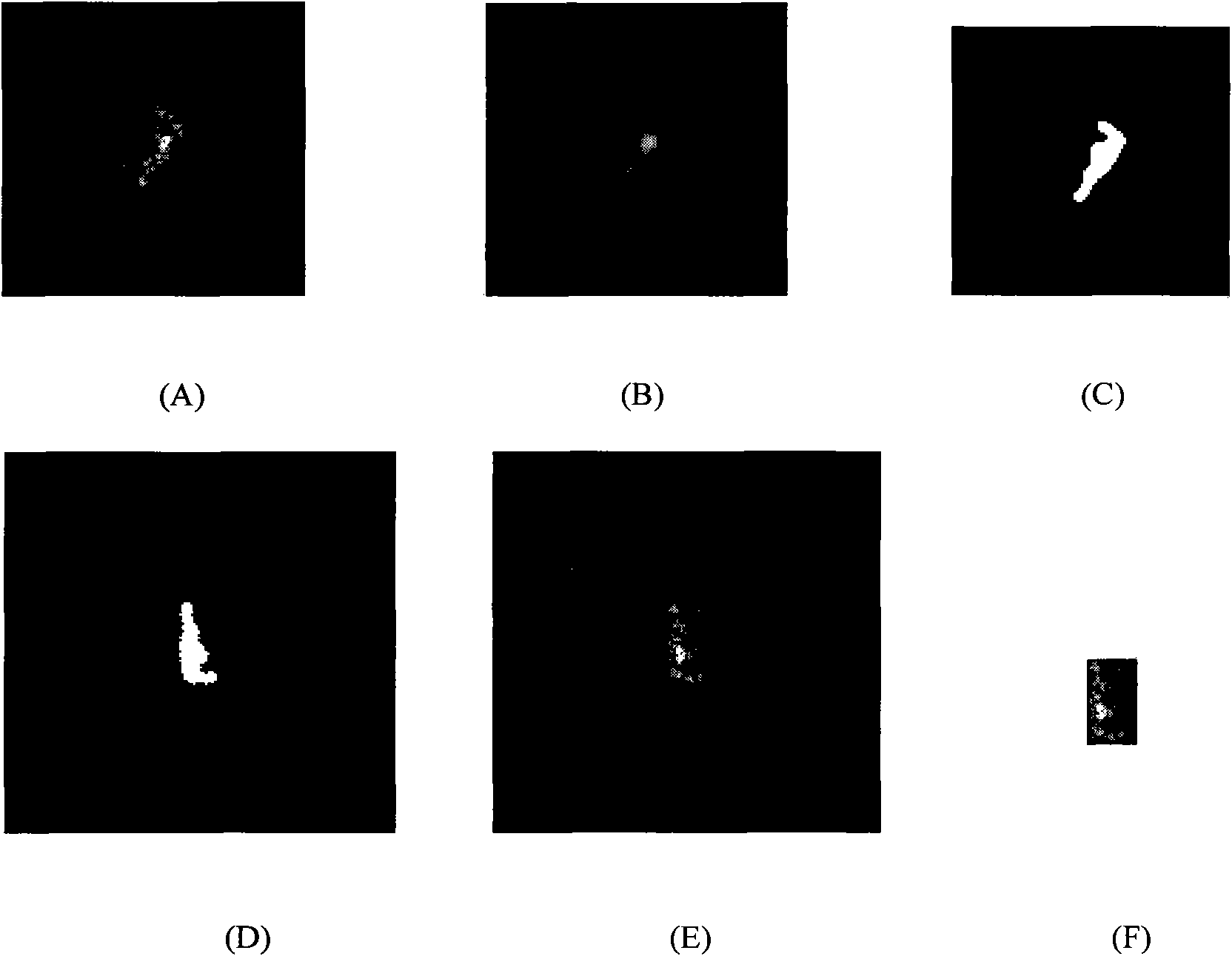 SAR variant target identification method based on local textural feature