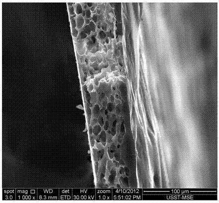 Carbon foam material with core-shell structure and method for preparing carbon foam material