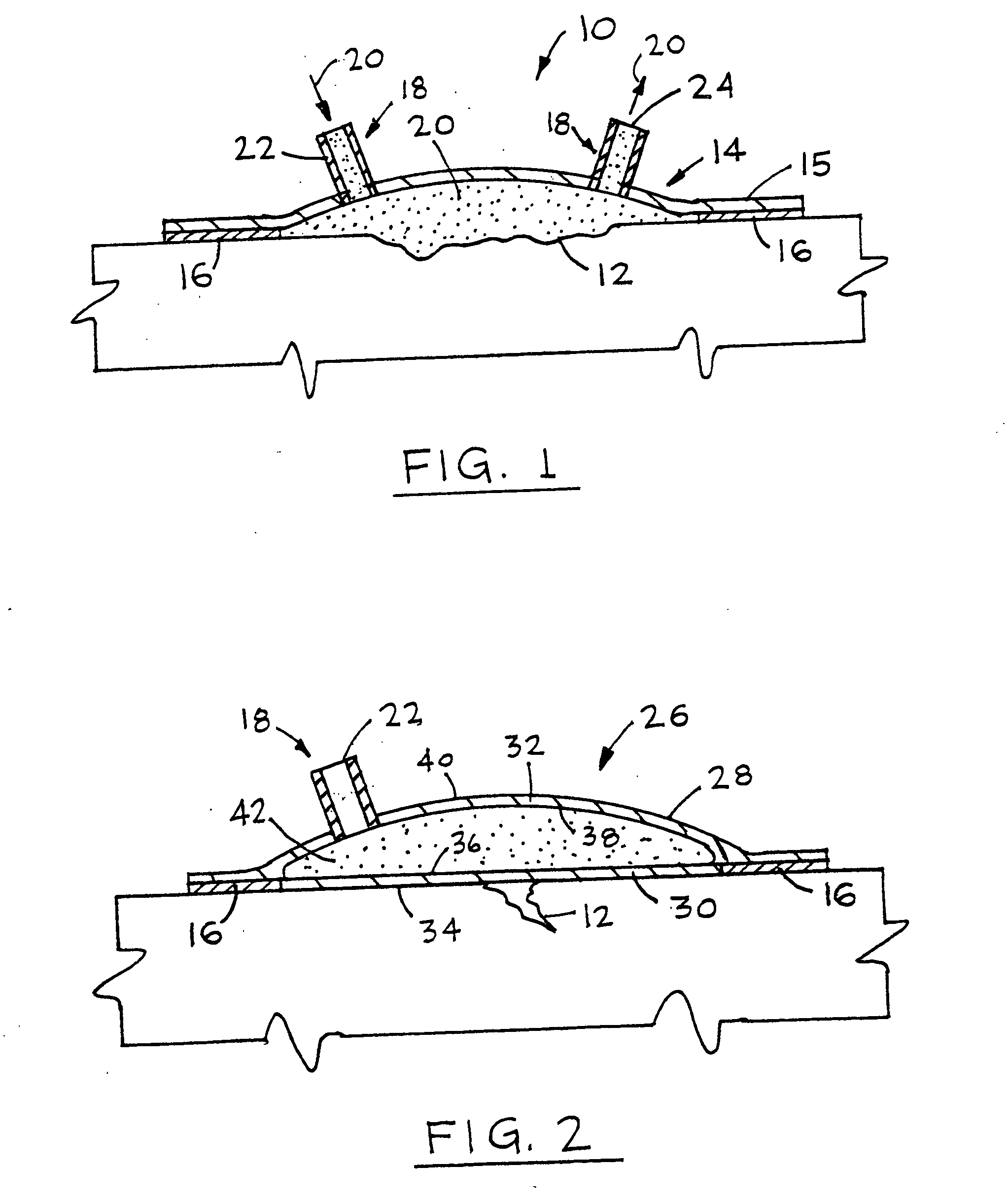 Device for treating and promoting healing of damaged body tissue