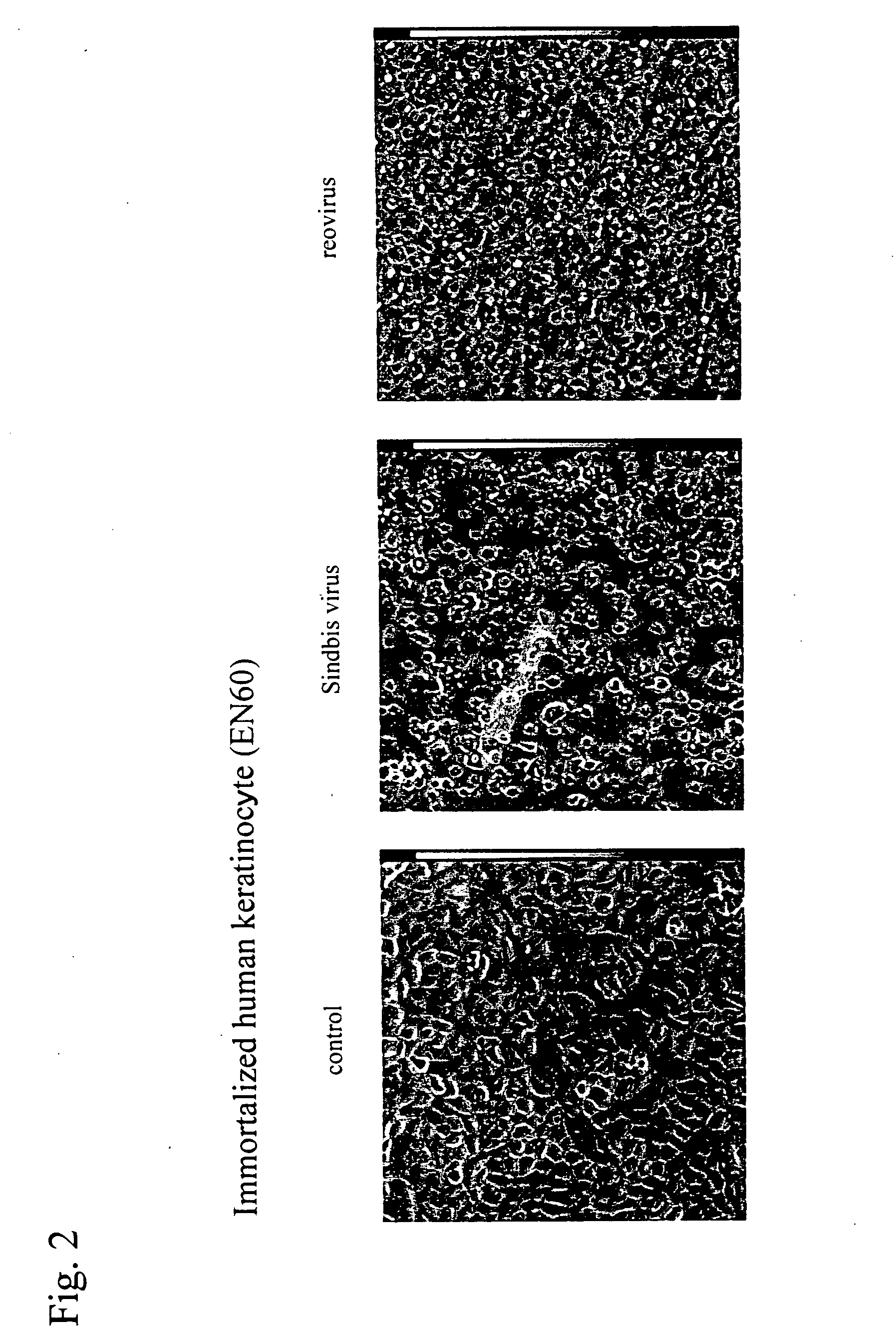Pharmaceutical composition for treatment of cancers