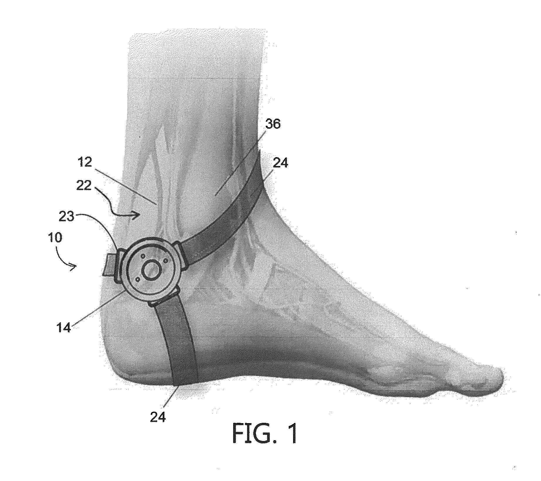 Apparatus for transcutaneous electrical stimulation of the tibial nerve