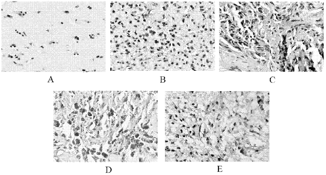 Application method of low-methylation gene LMO3 (LIM domain only 3)