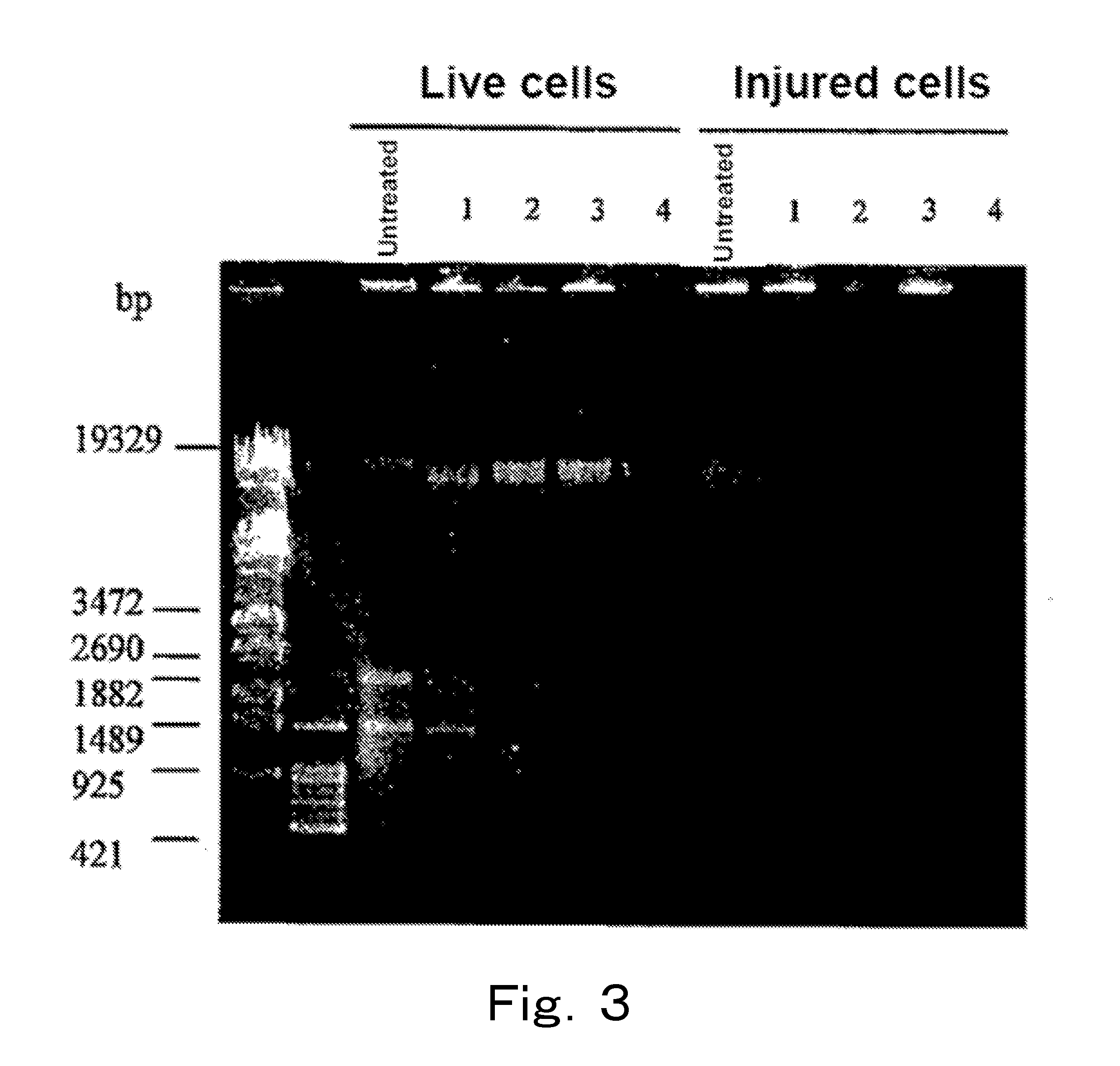 Method for detection of microorganism and kit for detection of microorganism