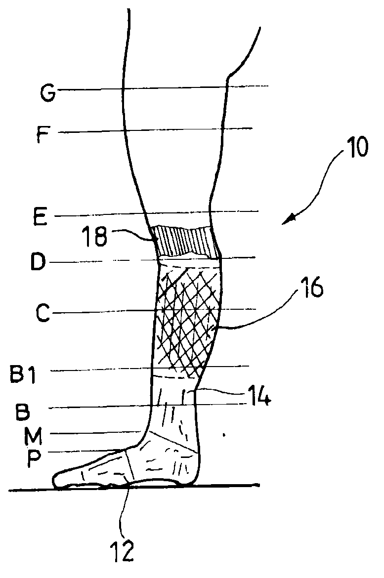 Adapted compression/splint orthosis for reinforcement of the calf musculoaponeurotic pump