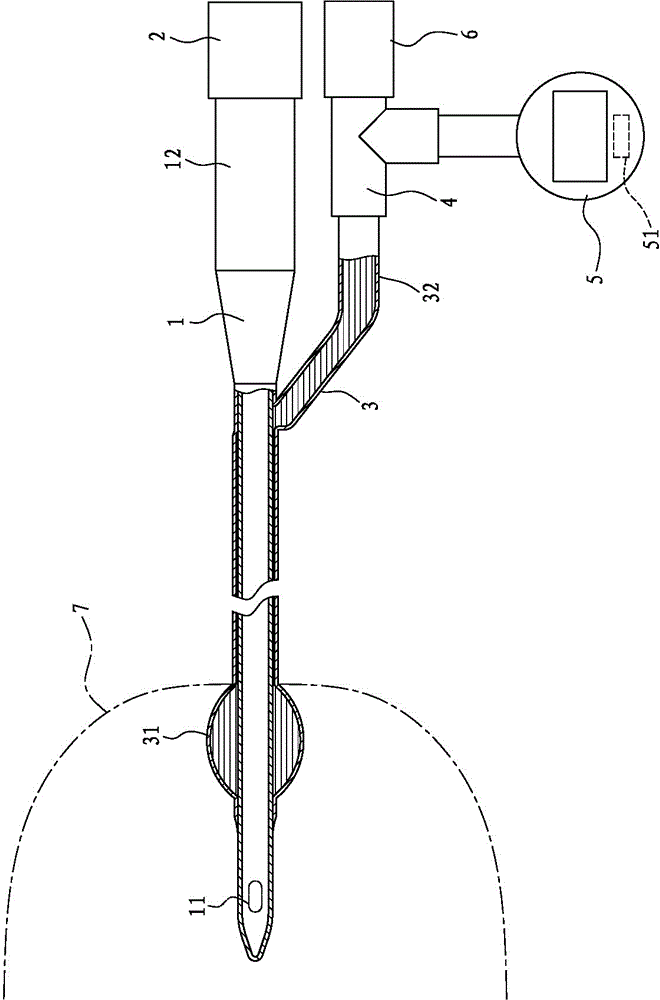 Bladder pressure detecting device and method for analyzing opportunity of patient for removing catheter