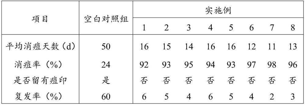 External liquid medicine with acne removing effect and preparation method thereof