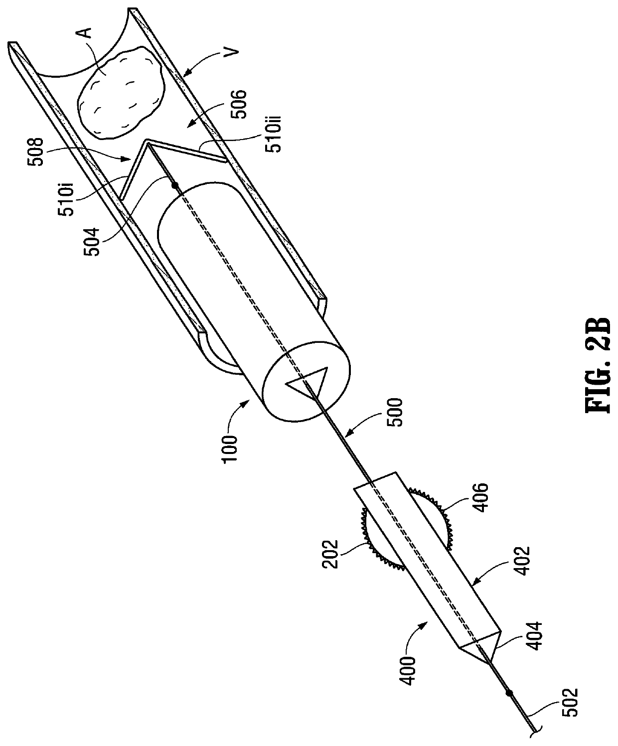 Orientable implantable device and method