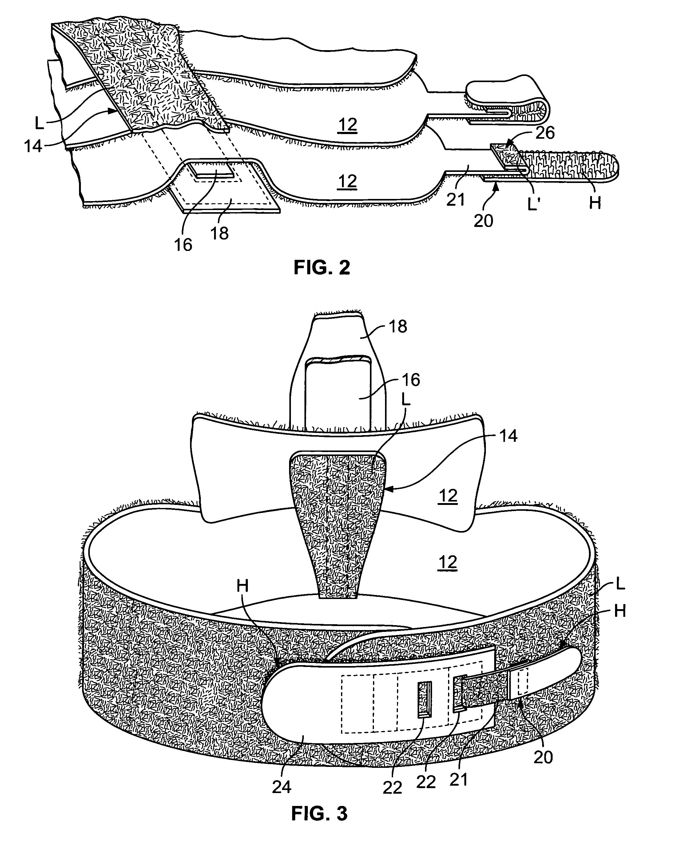 Therapeutic device having auxiliary strap holding positions