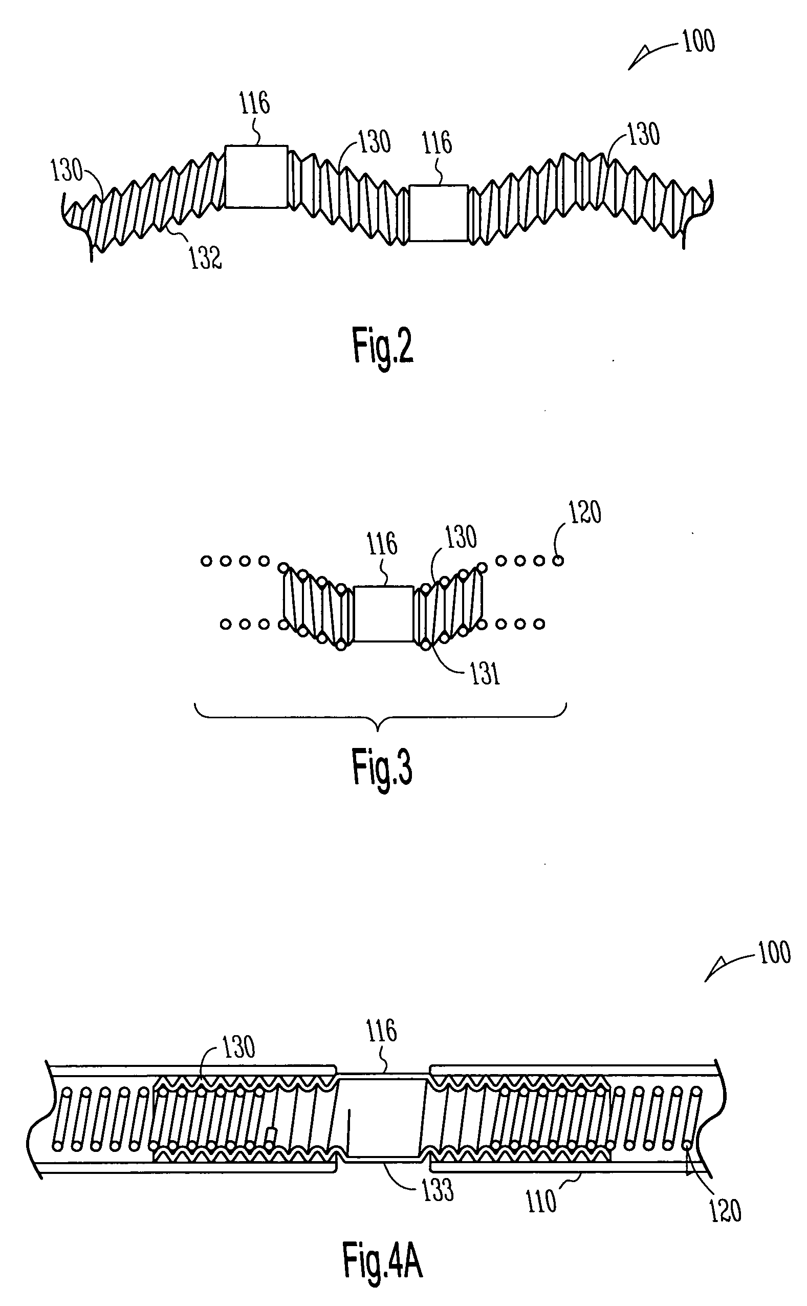 Lead assembly with flexible portions and method therefor