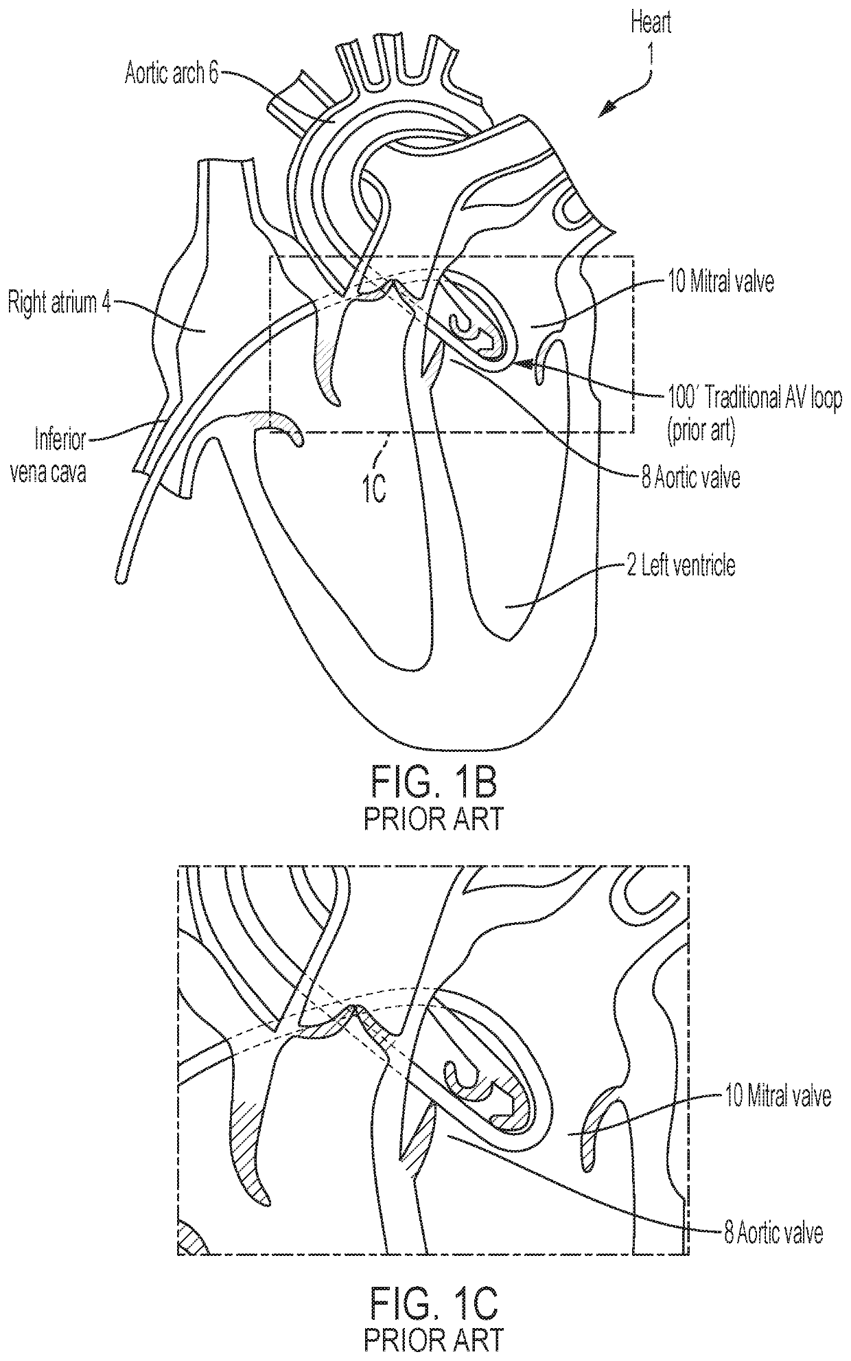 Apparatus and methods for delivery of prosthetic heart valves