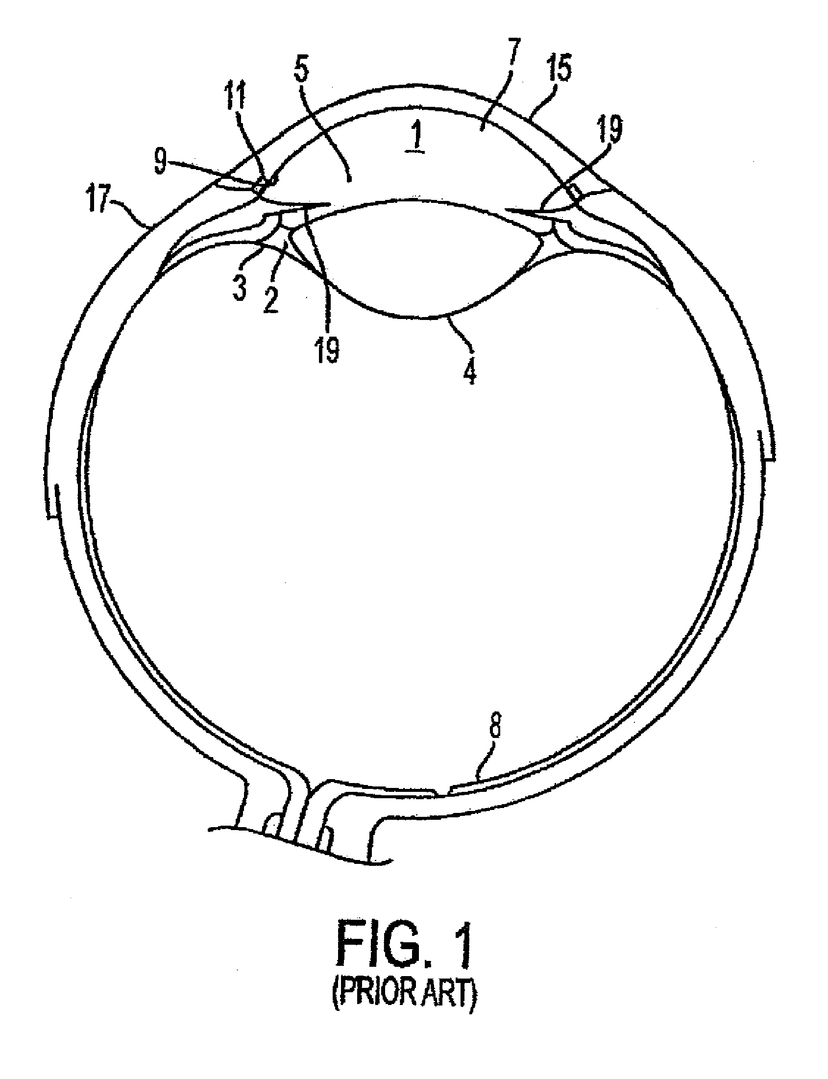 Methods and apparatuses for the treatment of glaucoma using visible and infrared ultrashort laser pulses