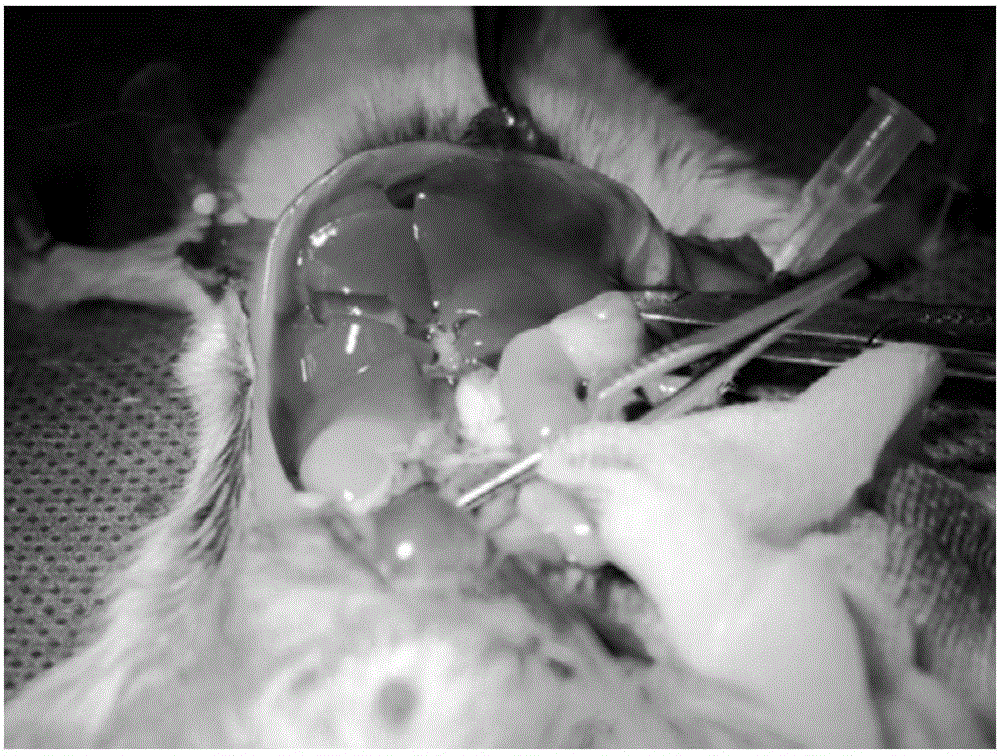 Method for establishing Mongolian gerbil orthotopic liver transplantation model and method for separating hepatic stellate cells