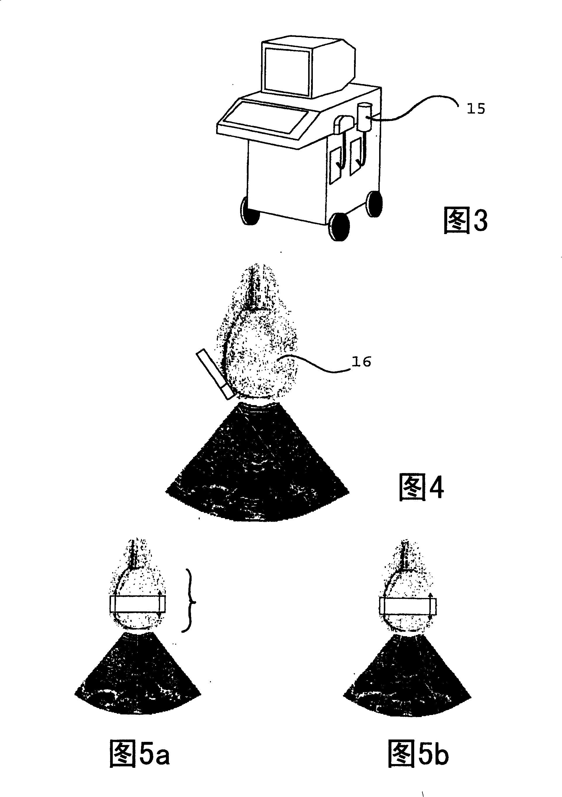 Device and method for measuring the elasticity of a human or animal organ