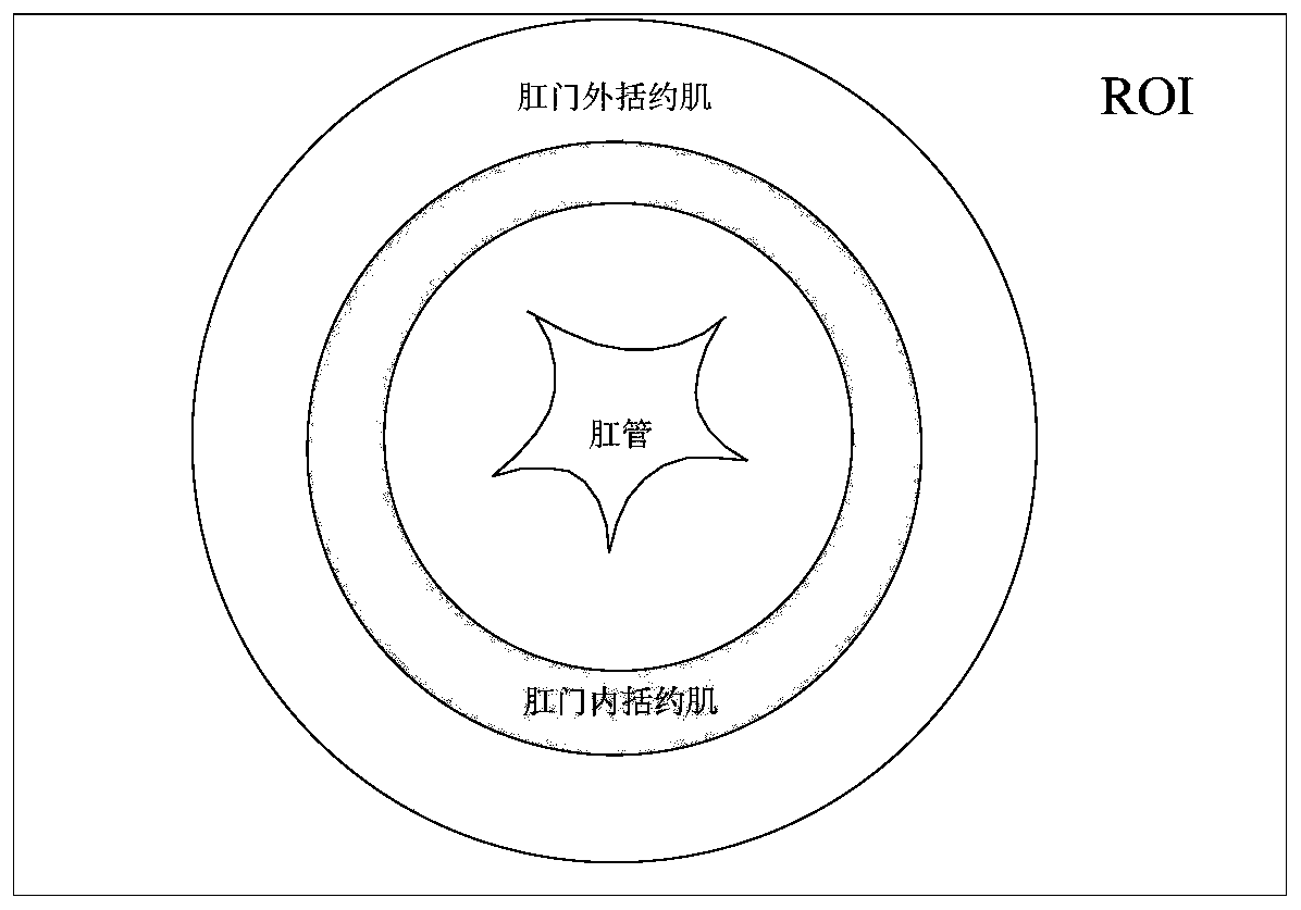 Anal sphincter image processing method and device, ultrasound equipment