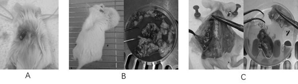 Method for establishing human-derived tumor xenograft model cultured in vitro
