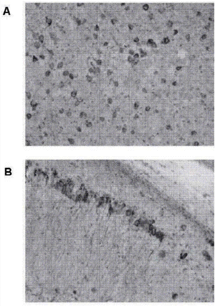 Humanized tau antibody