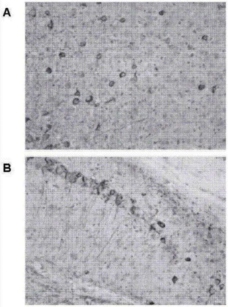 Humanized tau antibody