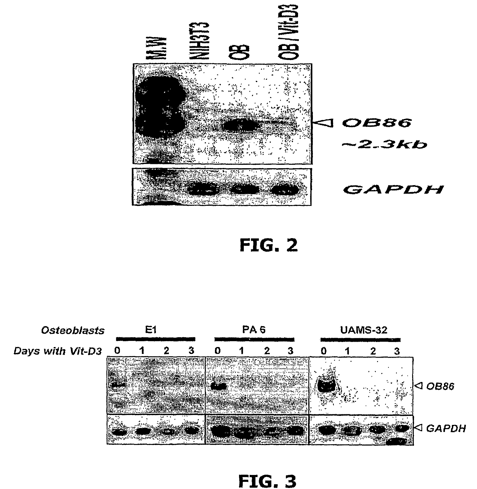 Methods for regulating osteoclast differentiation and bone resorption using LRRc17