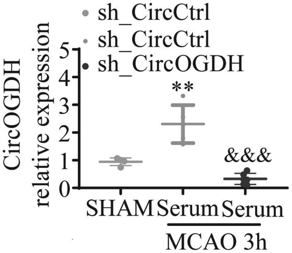 Application of plasma exosome CircOGDH as diagnostic biomarker of acute ischemic stroke