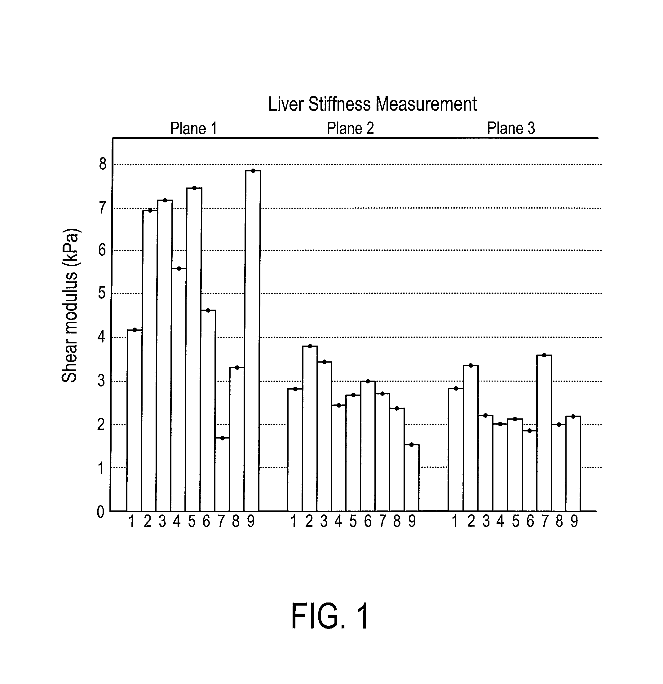 System and method for mapping ultrasound shear wave elastography measurements
