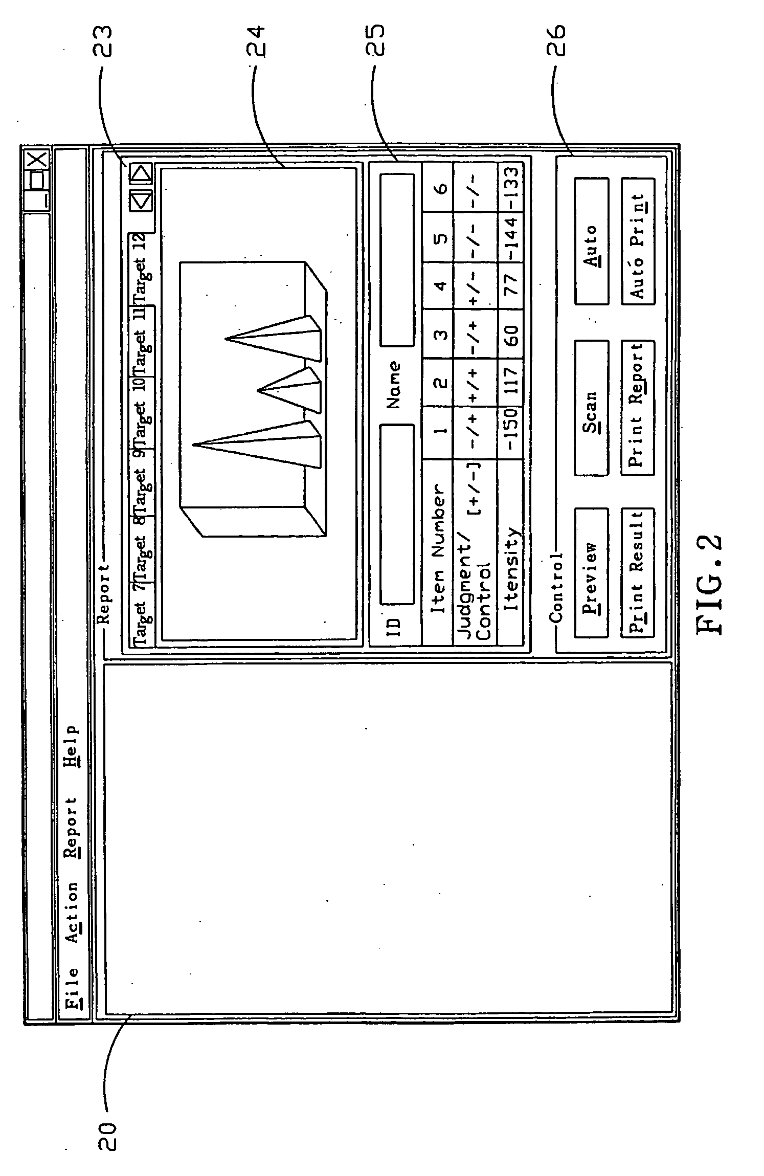 Method of automatically detecting a test result of a probe zone of a test strip
