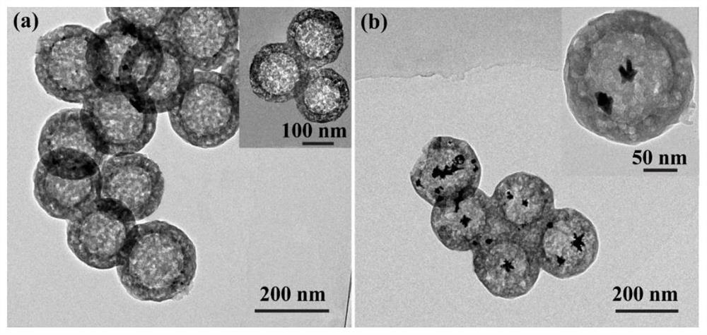 A Venus core/hollow silicon shell drug-loaded nano-platform and its preparation and application