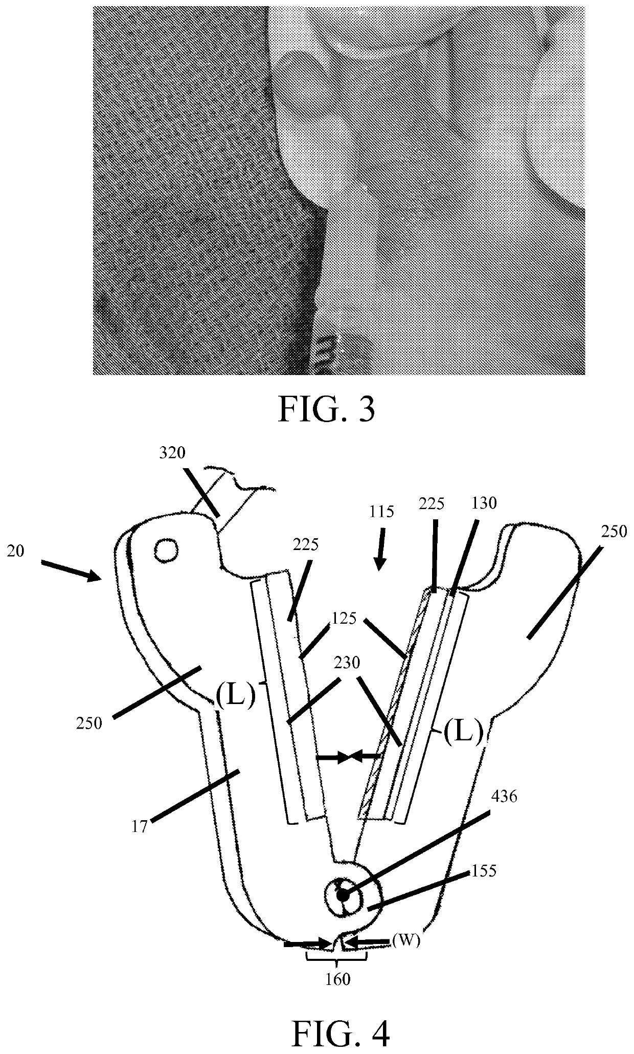 Devices and methods for removing unwanted tissue