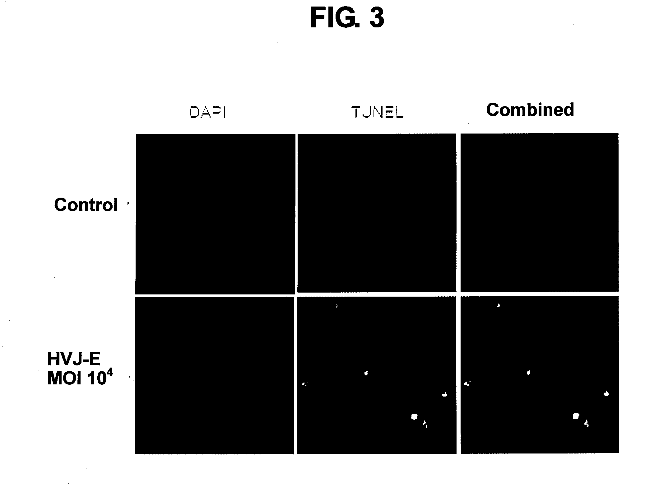 Therapeutic/prophylactic agent for prostate cancer