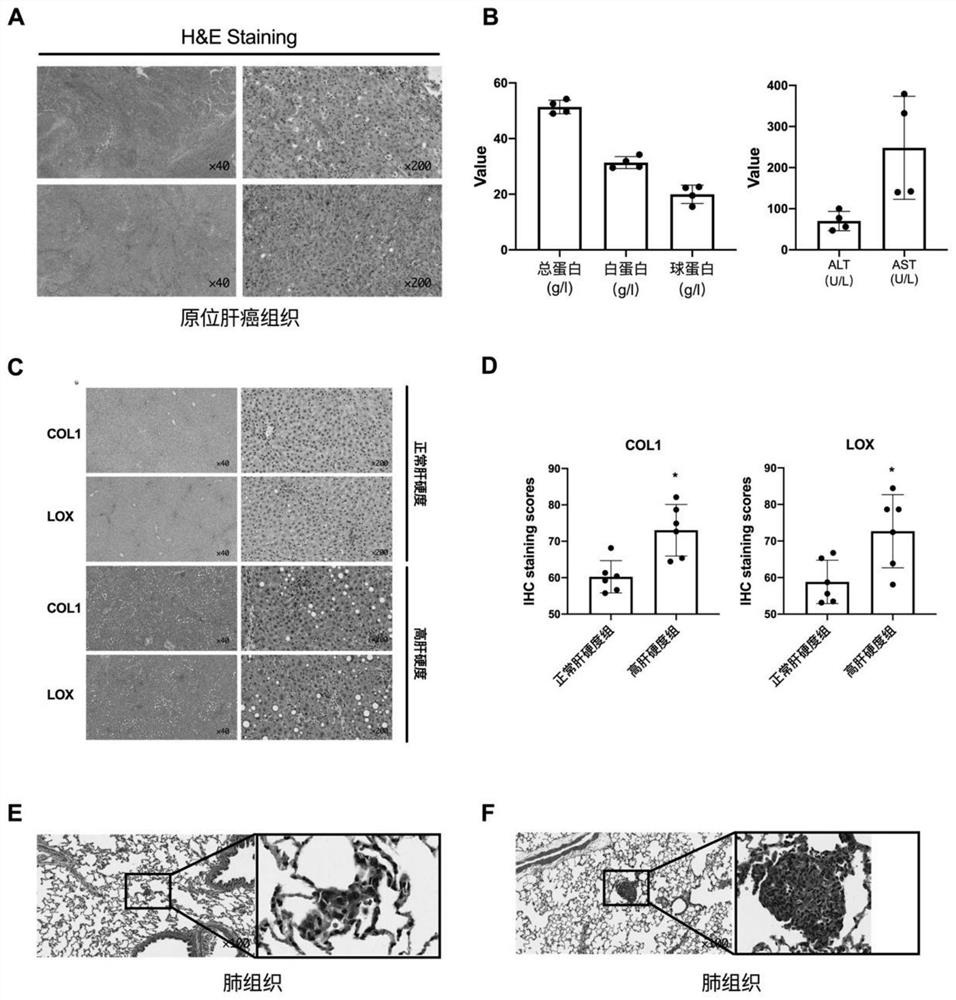 Construction method of in-situ liver cancer model of SD rats (Sprague-Dawley) having high liver hardness background, and application thereof