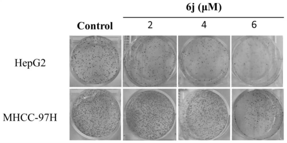 Application of sophoridine derivative 6j in preparation of ferroptosis inducer