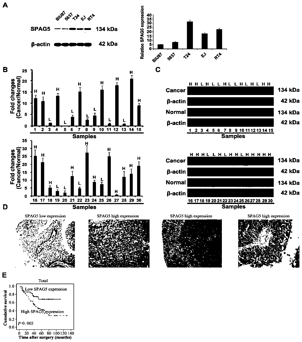 Application of spag5 as a target site in the preparation of drugs for the treatment of bladder cancer