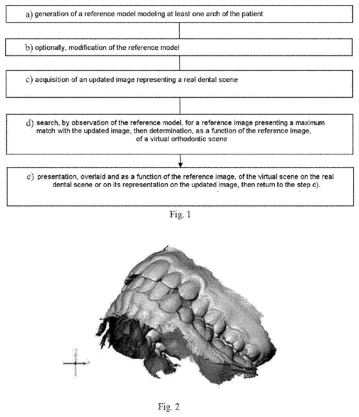 Method for analysing a dental situation