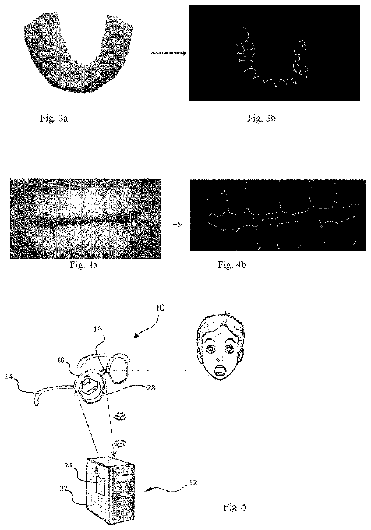 Method for analysing a dental situation