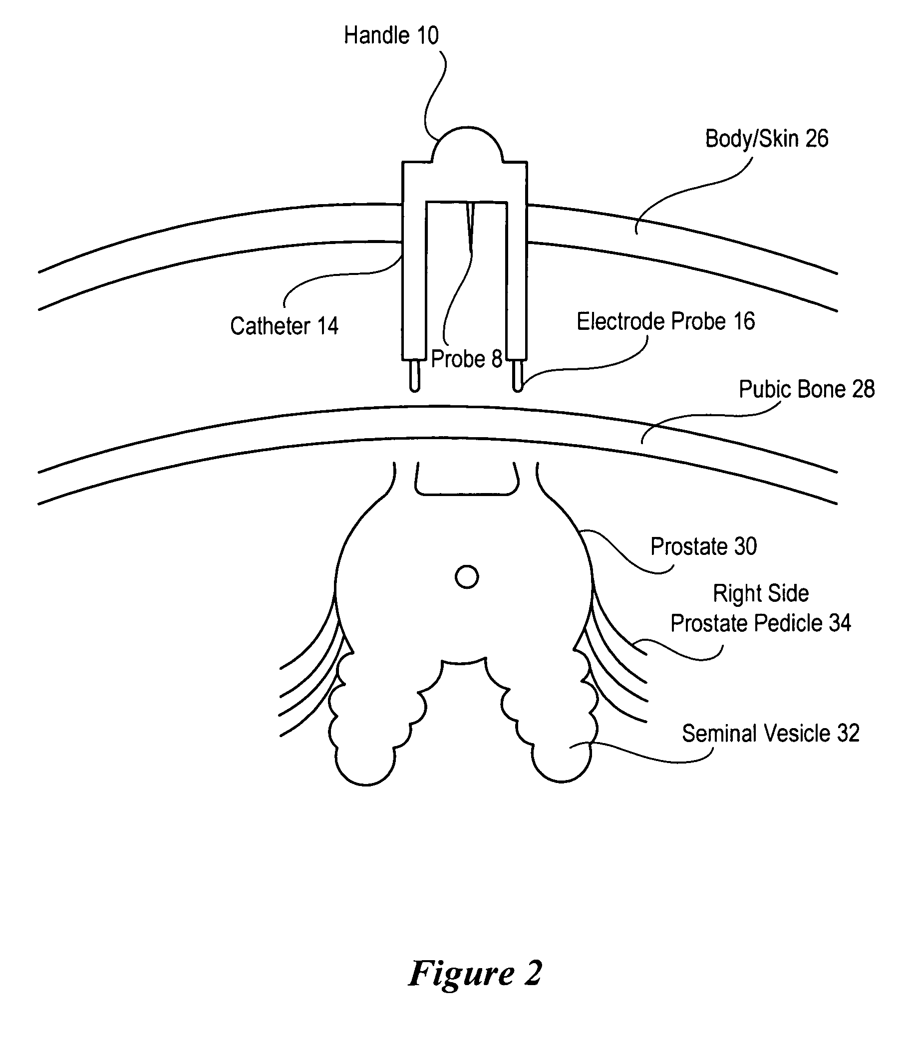 System and method for laparoscopic nerve detection