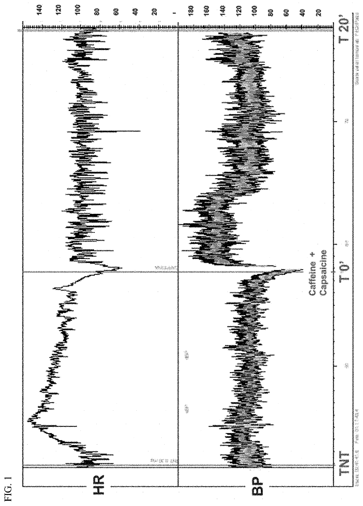 Sublingual formulation for hypotension and syncope