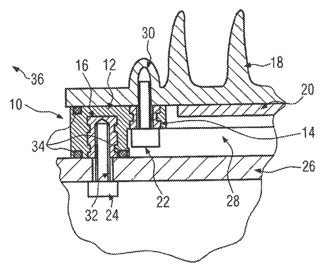 Connection device for connecting an electronic component to a housing part and electronic controller