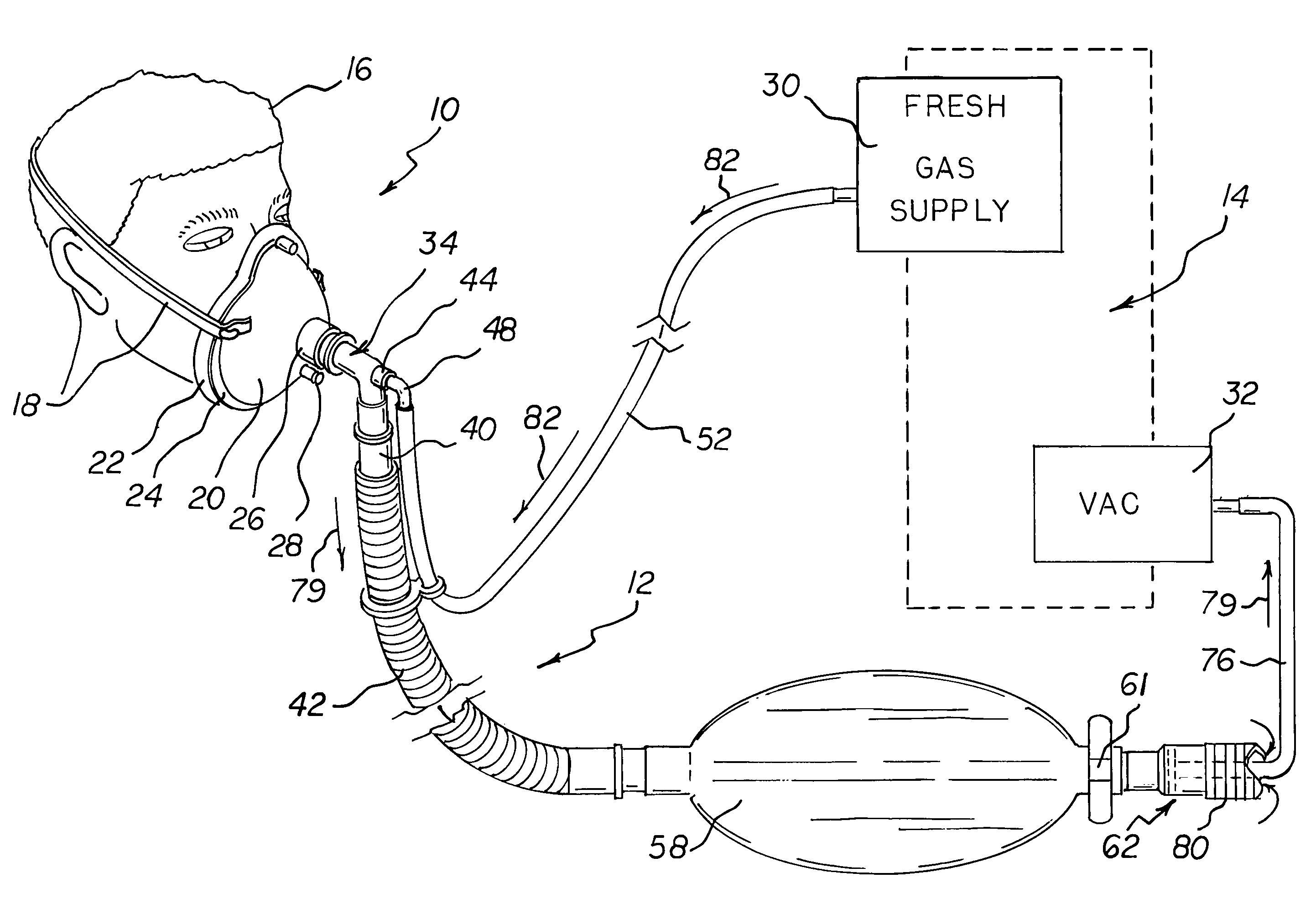 Respiratory face mask and breathing circuit assembly