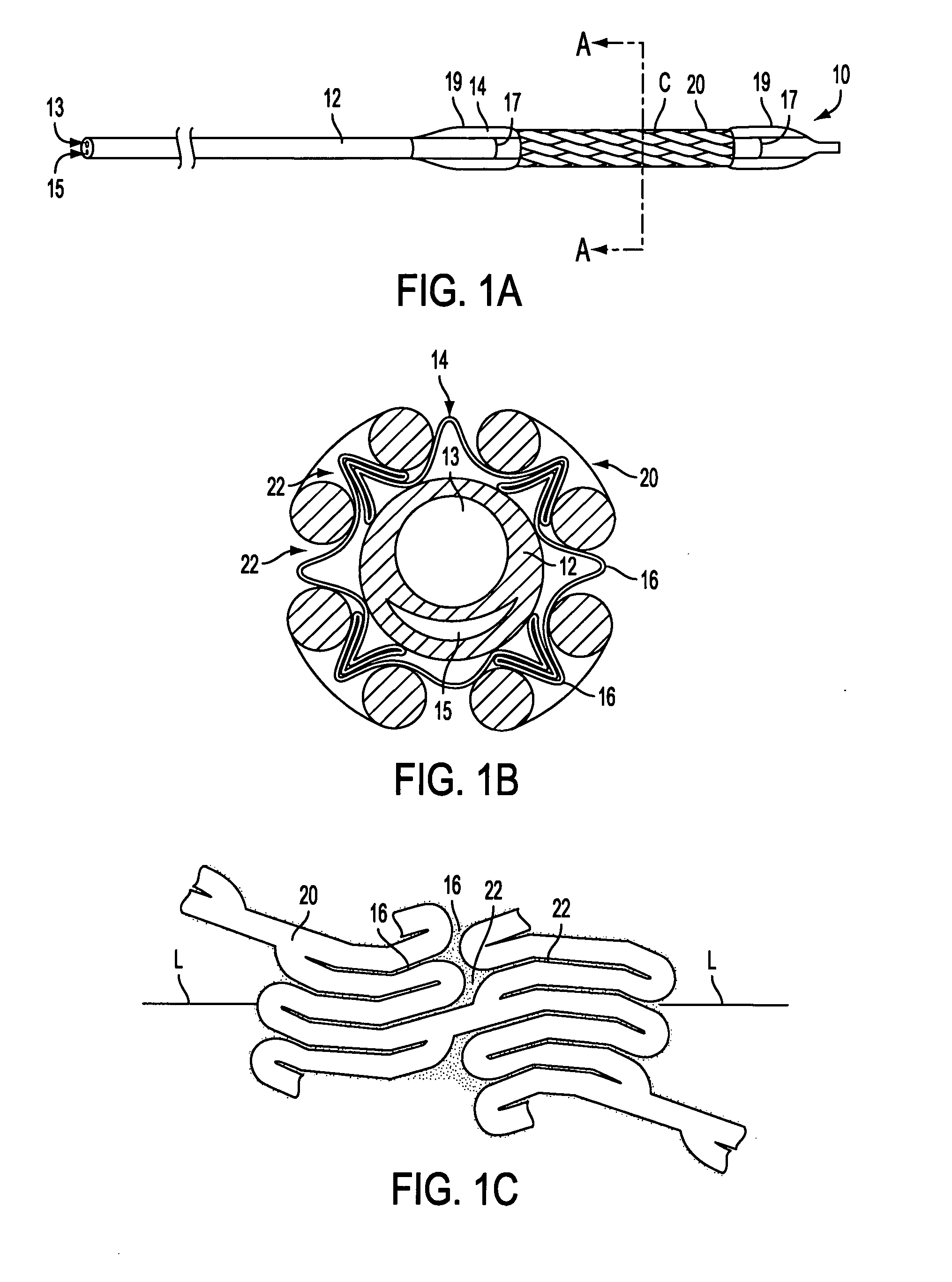 Cold-molding process for loading a stent onto a stent delivery system