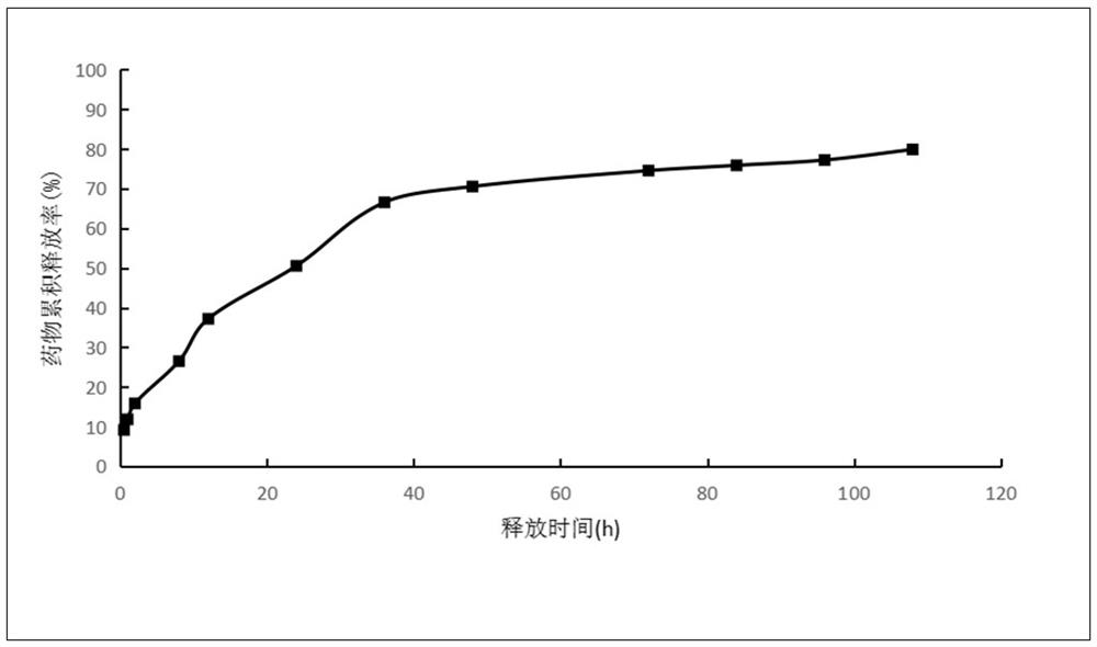 Specific anti-porphyromonas gingivalis egg yolk antibody liposome solution and preparation method thereof