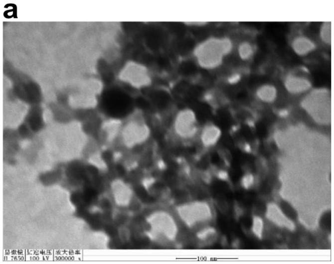 Specific anti-porphyromonas gingivalis egg yolk antibody liposome solution and preparation method thereof