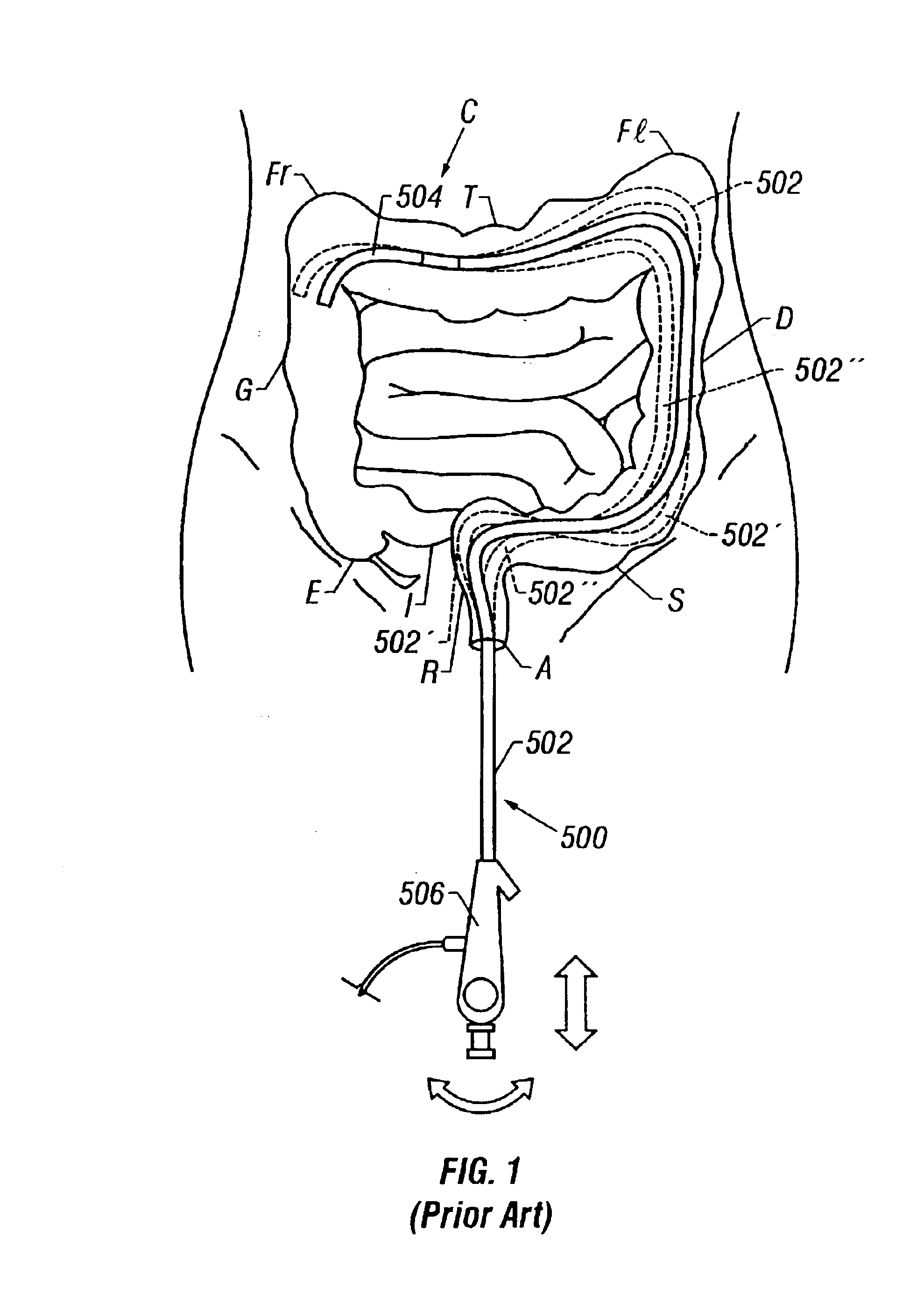 Steerable segmented endoscope and method of insertion