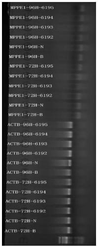 A kind of RNAi and its application in the preparation of drugs for treating liver cancer