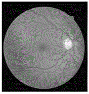 Eye fundus image vessel segmentation method based on local enhancement active contour module