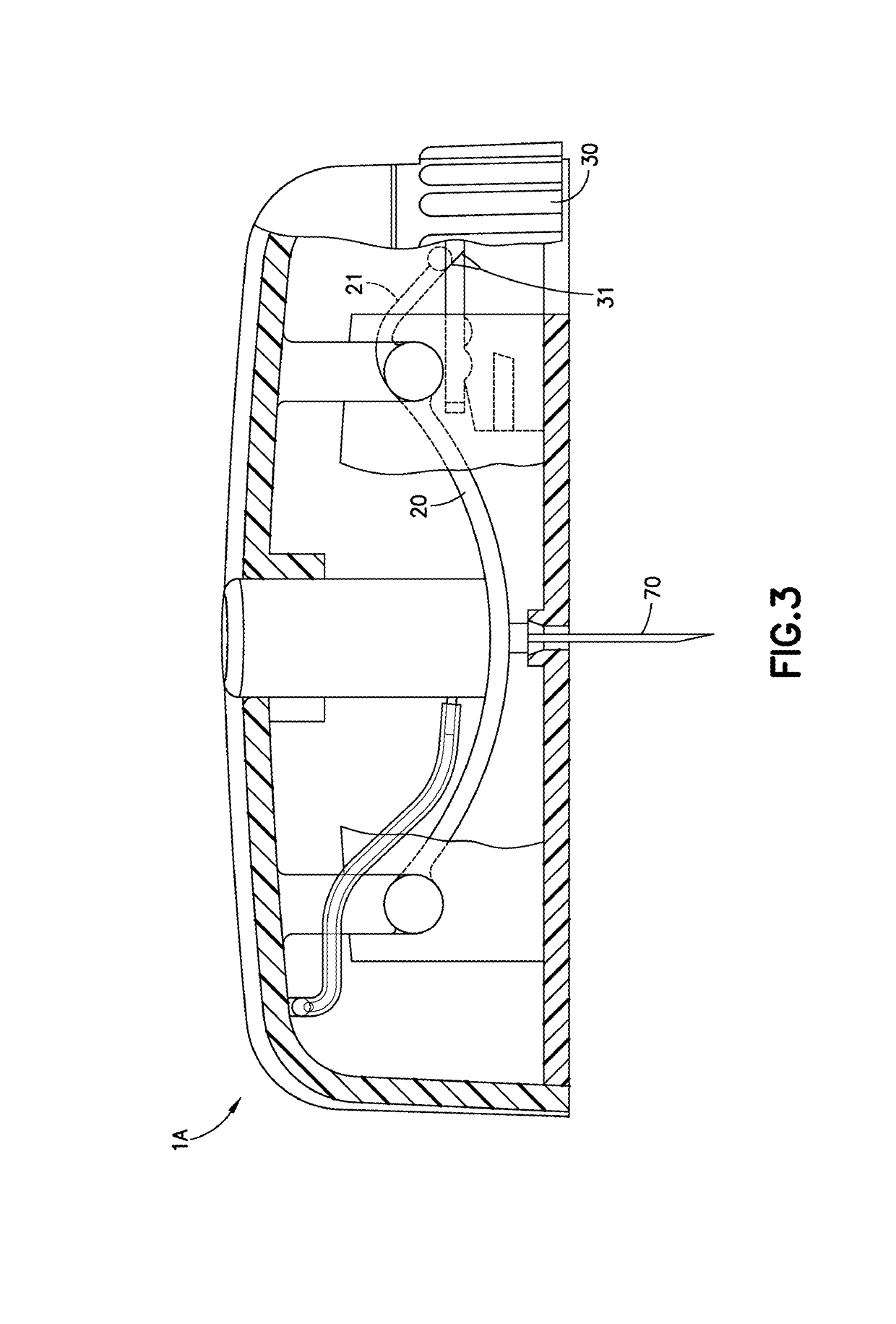 Cannula insertion and retraction device for infusion device
