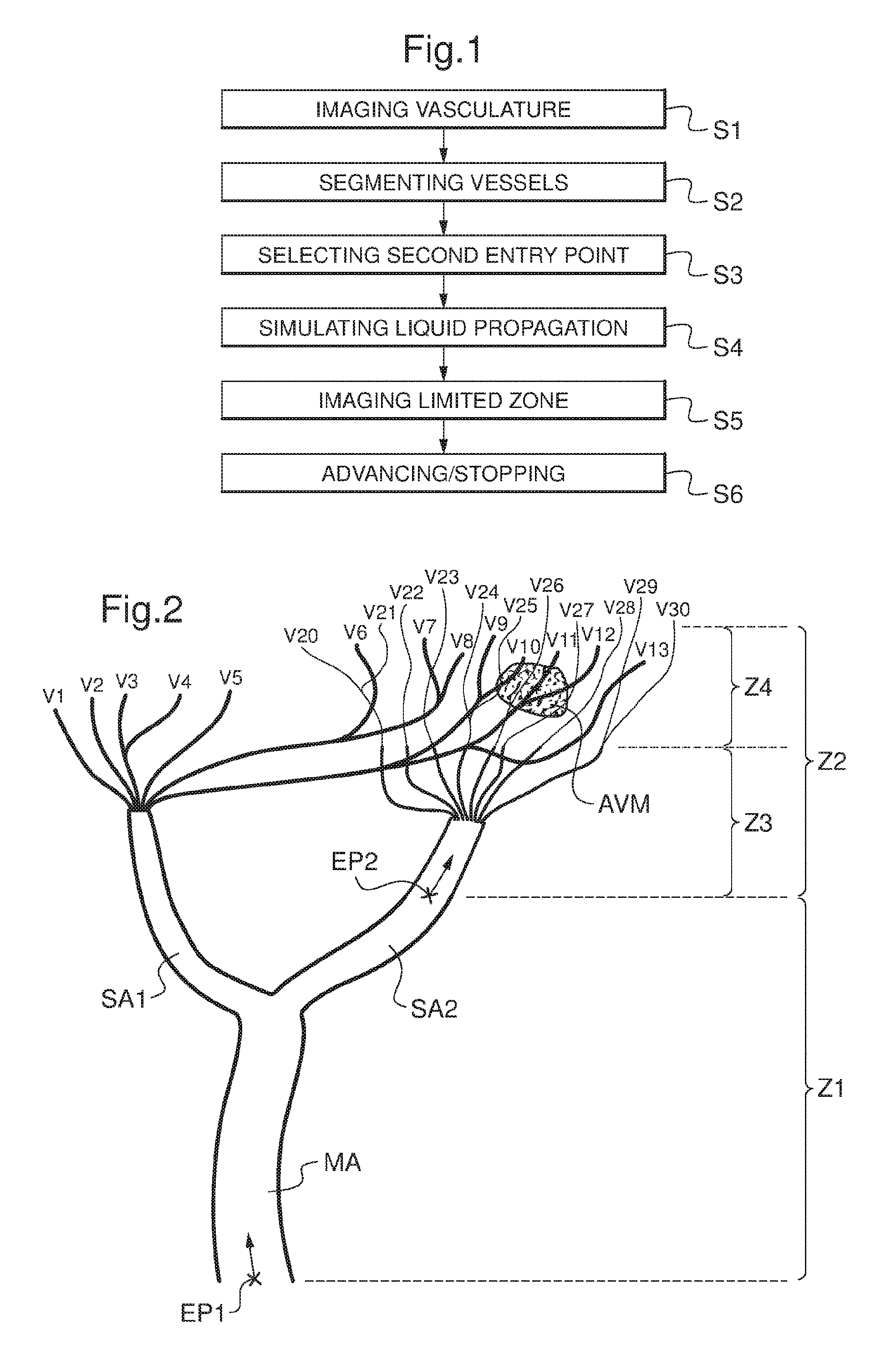 Three dimensional imaging method of a limited zone of a patient's vasculature