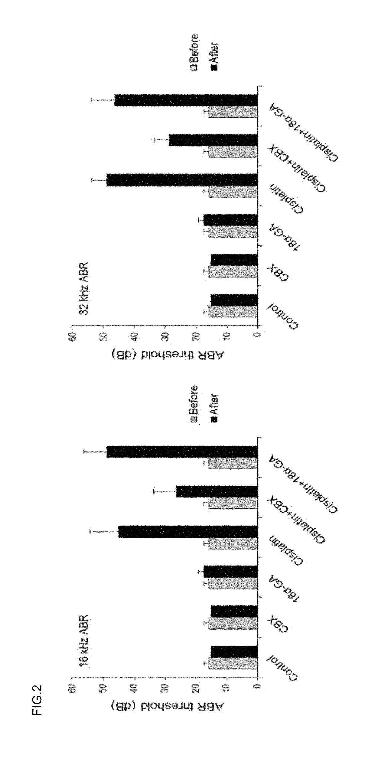 Pharmaceutical composition for preventing or treating hearing loss, comprising carbenoxolone or its pharmaceutically acceptable salts as effective compound