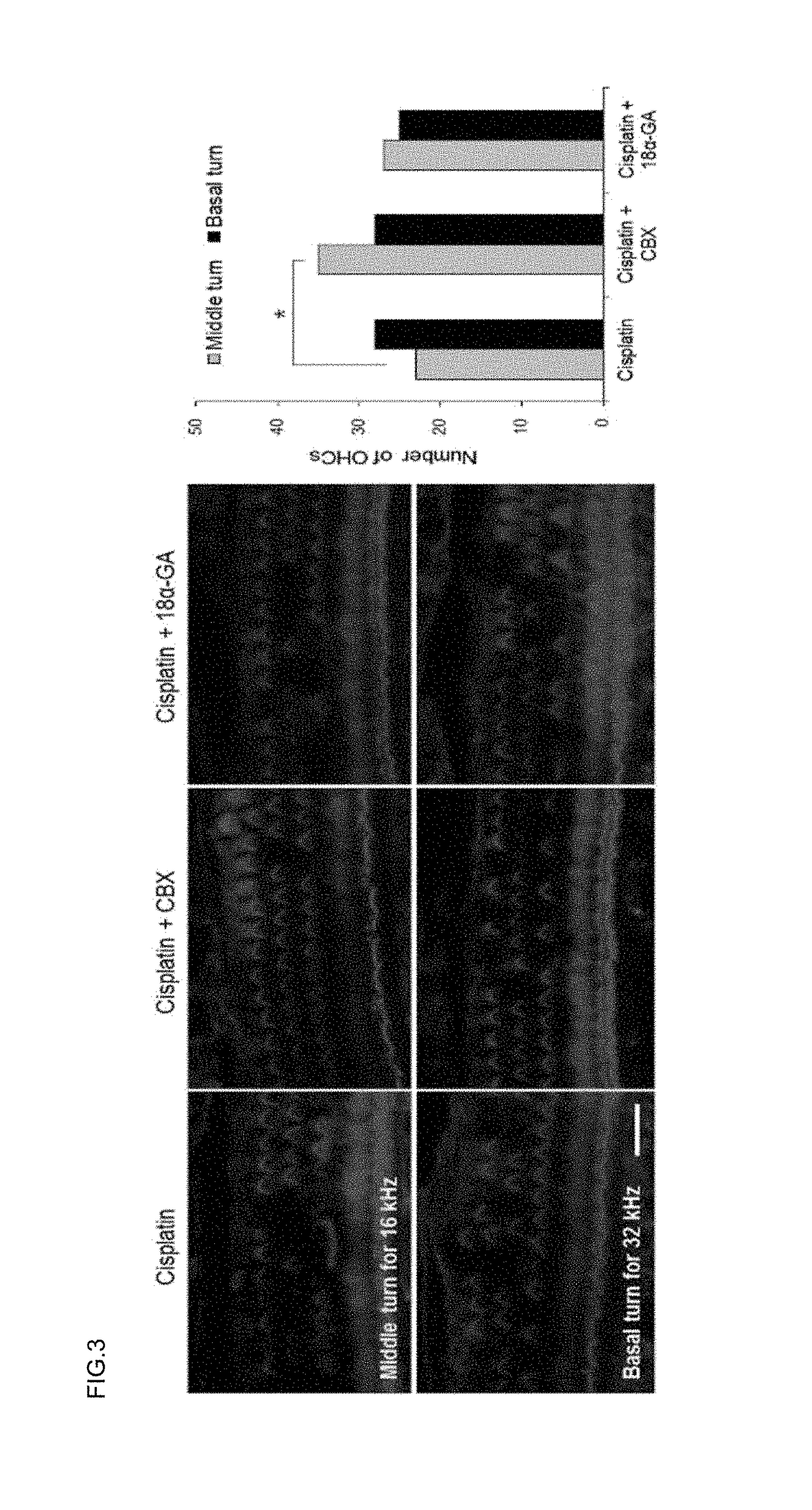 Pharmaceutical composition for preventing or treating hearing loss, comprising carbenoxolone or its pharmaceutically acceptable salts as effective compound